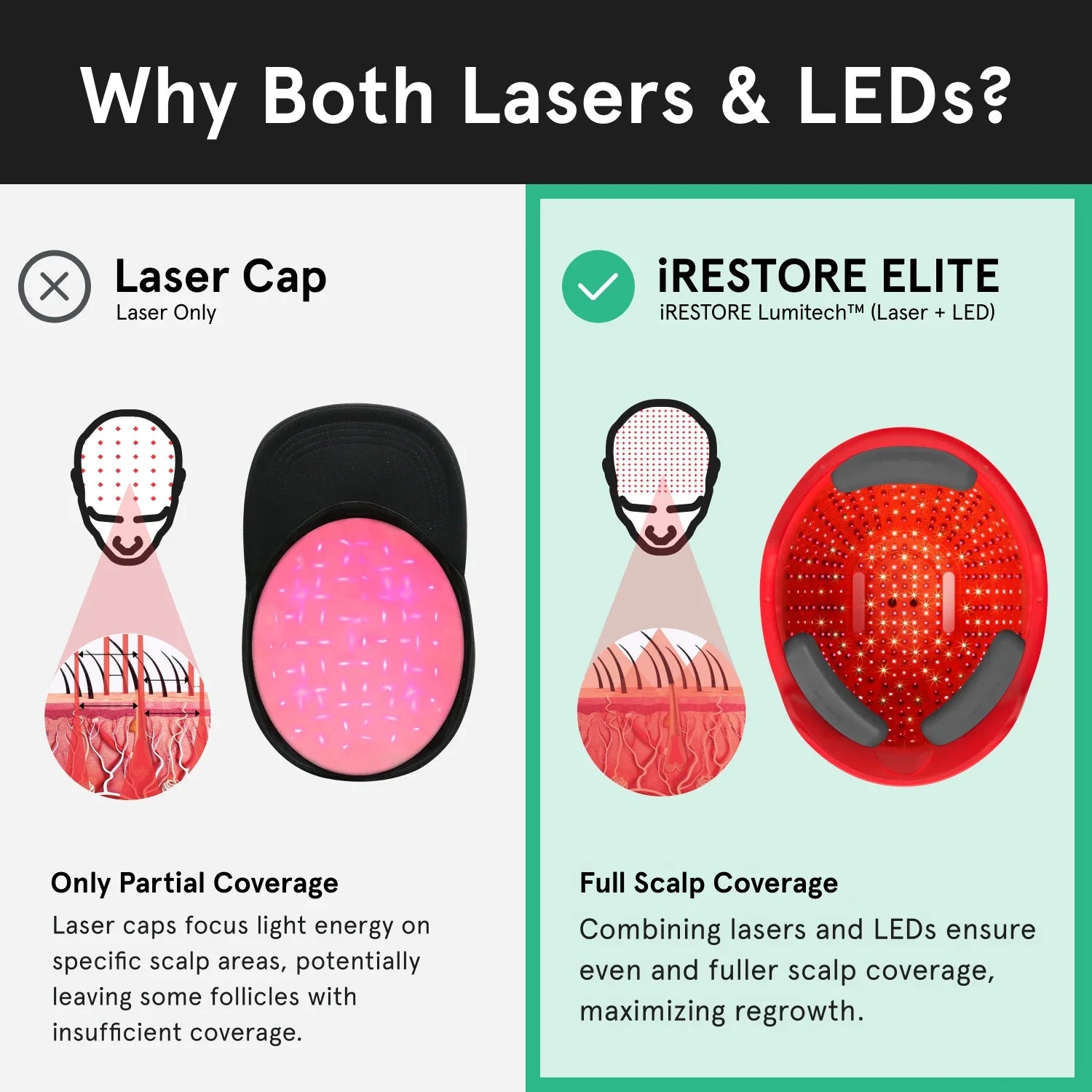 An image comparing the iRESTORE Elite with other laser cap. Laser caps only have partial coverage, laser caps focus light energy on specific scalp areas, potentially leaving some follicles with insufficient coverage. While the Elite device have full scalp coverage, combining lasers and LEDs ensure even and fuller scalp coverage, maximizing regrowth.